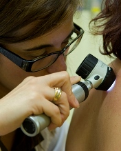 CHLP realiza rastreios gratuitos do melanoma